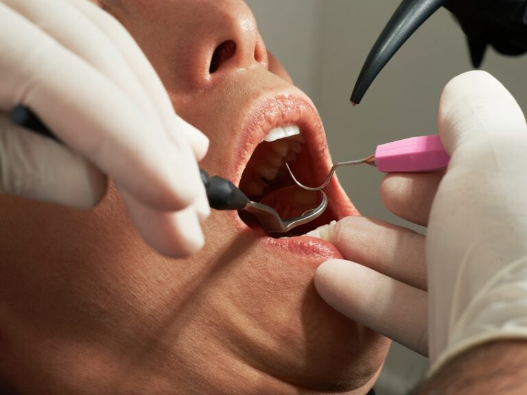 February 29, 2024: Suboxone Tooth Decay Lawsuit Update