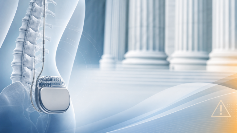 Boston Scientific spinal cord stimulator lawsuits: the new MDL is now in California